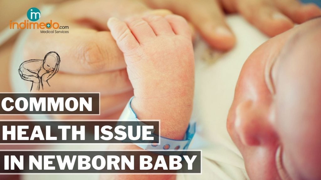 Common Newborn Baby Health Issues