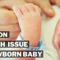 Common Newborn Baby Health Issues